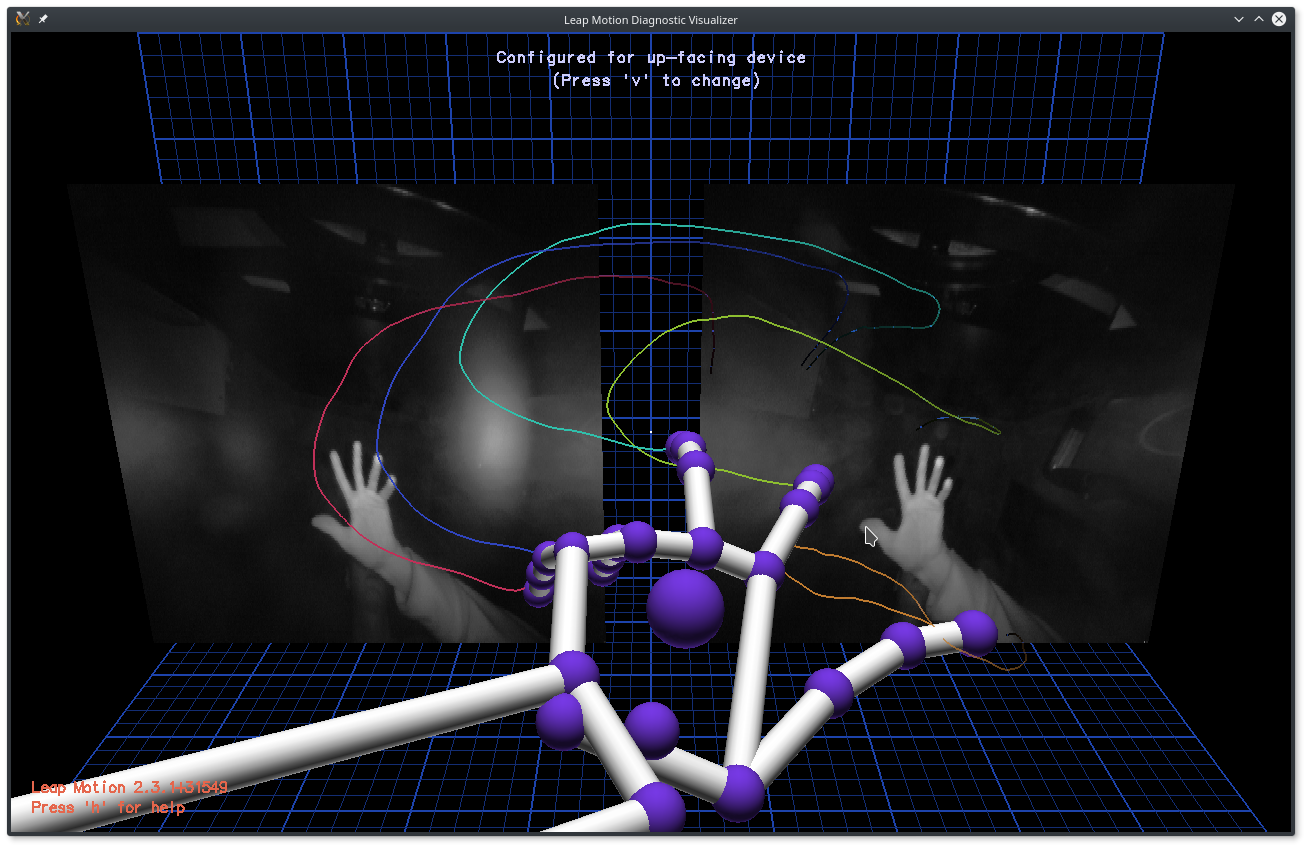 Diagnostic Visualizer